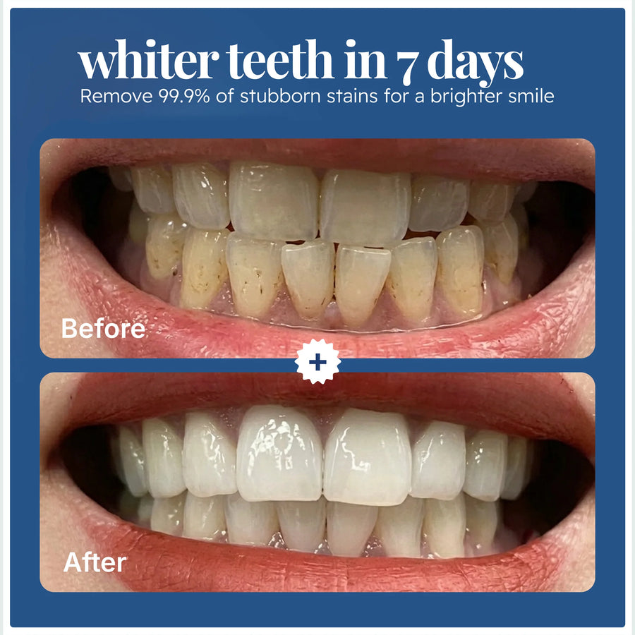 Natural Teeth Whitening Powder – Whiter Teeth in 7 Days Without Sensitivity